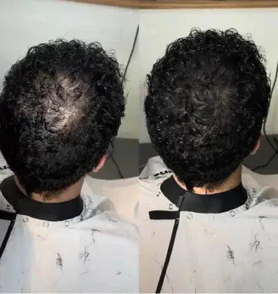 Cache-Cheveux Minéral — photo d'un client 4
